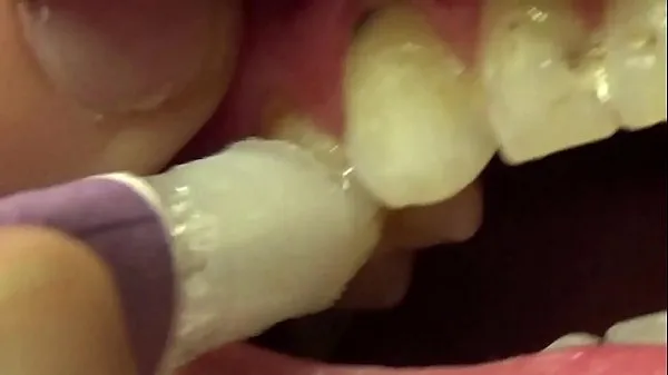 Najlepšie Applying Whitening Paste To Her Filthy Teeth najlepšie videá