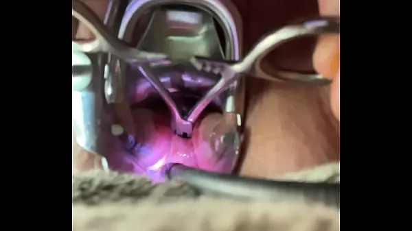 Best Pain opening hemastats while inside cervix best Videos