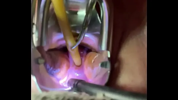 Best Catheterizing uterus painfully best Videos